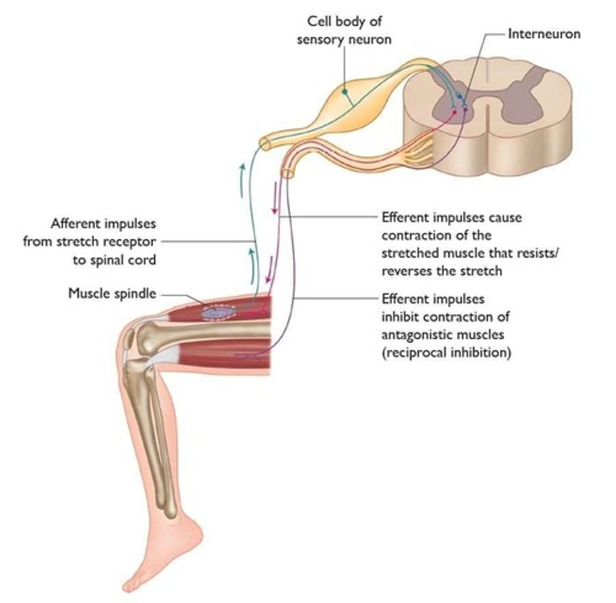 <p>A reflex where a noxious stimulus stimulates nociceptors, causing withdrawal of a limb, stimulating ipsilateral flexors, inhibiting ipsilateral extensors, and causing the opposite response in the contralateral limb.</p>