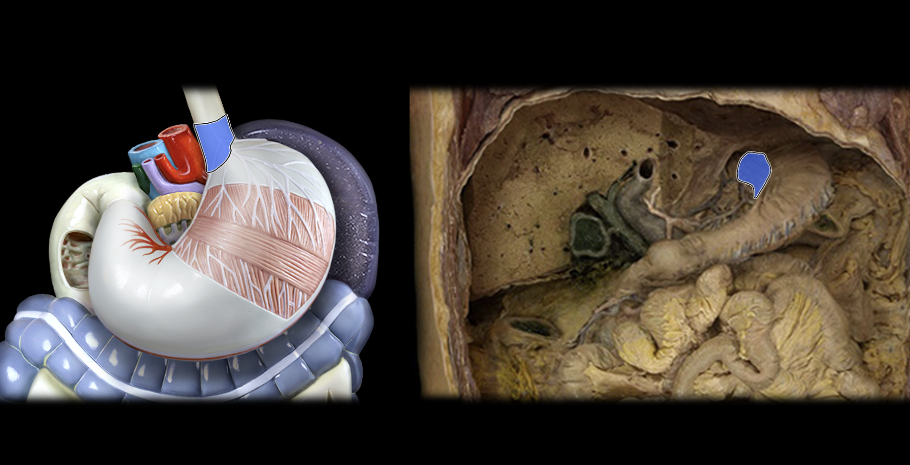 <p>Cardiac region of stomach</p>