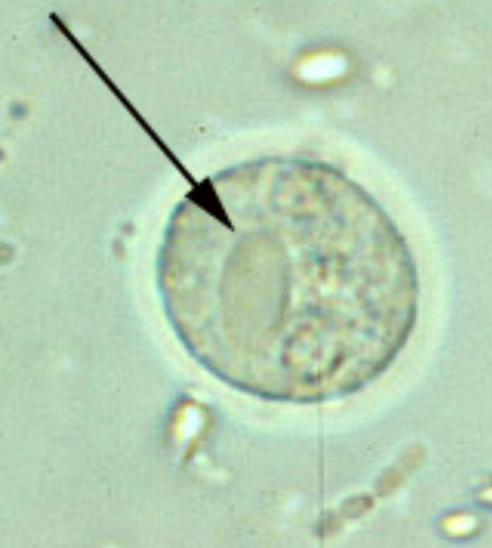 <p>Species Name:<br>Group:<br>Pointed in Arrow: <br>Stage:<br>Life Cycle Stages of this species:<br>How many nuclei does it have:</p>