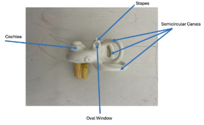 <p>staples, semicircular canals, oval window, cochlea</p>