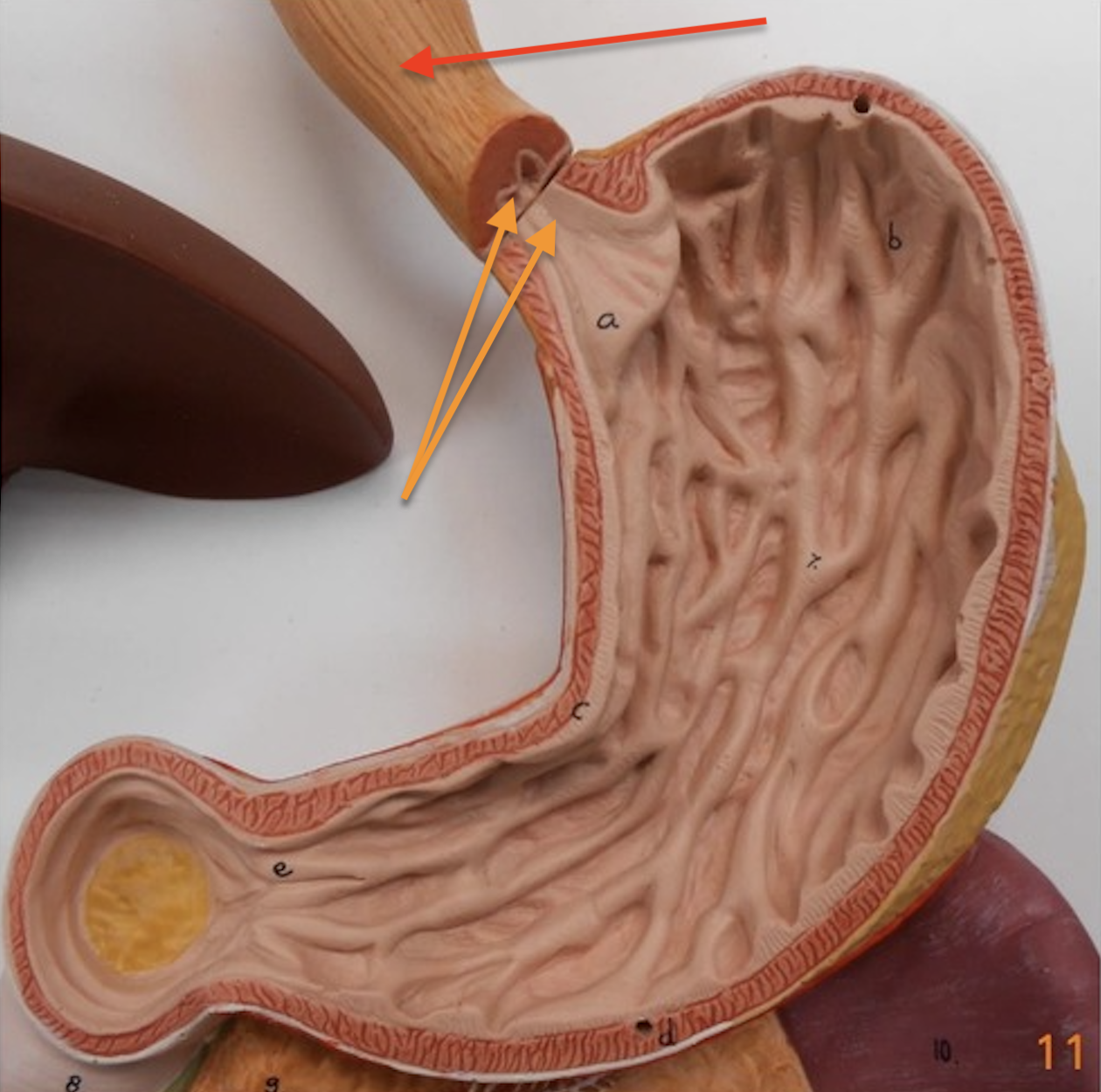 <p><span data-name="red_circle" data-type="emoji">🔴</span> →Esophagus</p><p><span data-name="orange_circle" data-type="emoji">🟠</span> → Esophageal sphincter of the stomach</p>