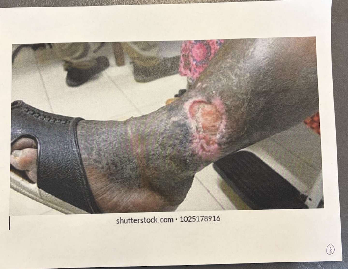 <p>what type of wound is this?</p>