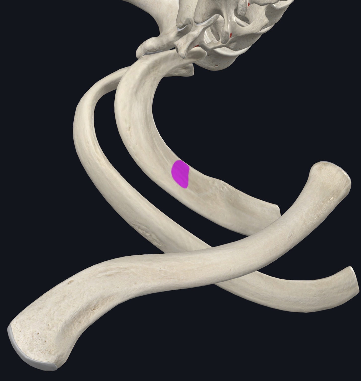 <p>Superior surface of 1st rib; Post. to groove for subclavian A.</p>