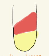 <p>TSI</p>