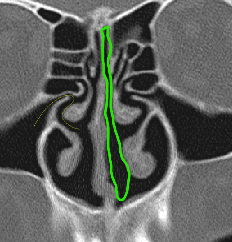 term image