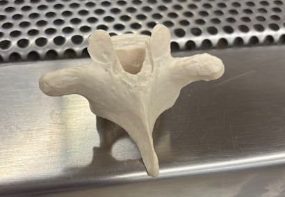 <p>What kind of vertebrae is this?</p>