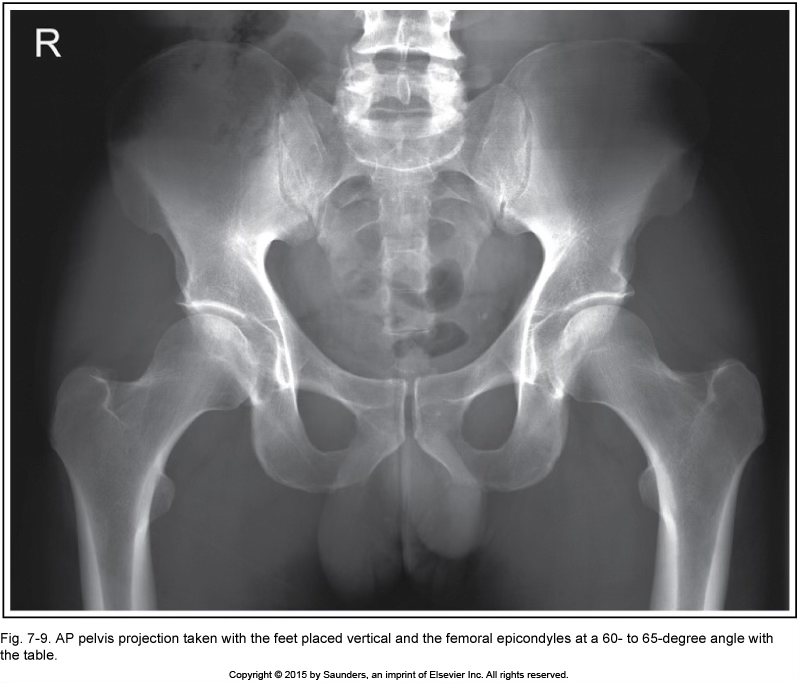 <p>AP pelvis</p>