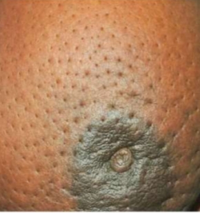 term image