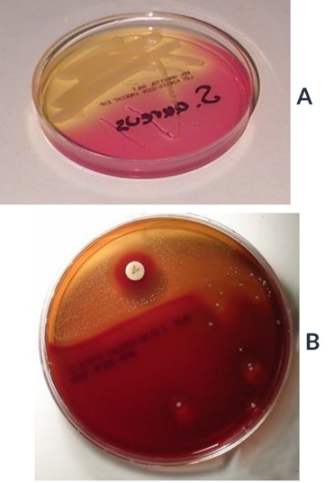 <p>Which of these plates will test positive for Catalase test?</p>