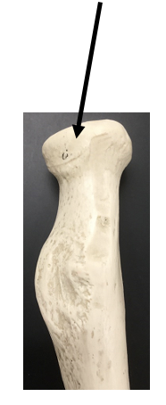 <p>What bone and bone feature is this?</p>