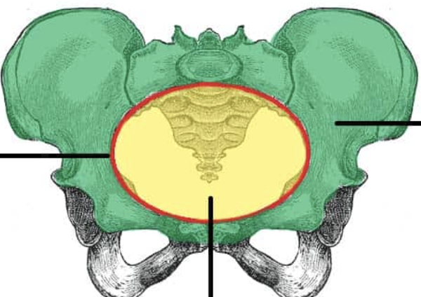 <p>Which pelvis is in green?</p>