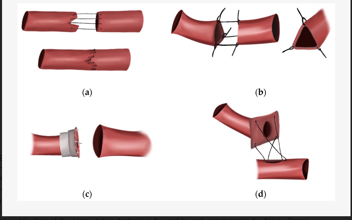 <p>present w/i the coronary cirulation</p><p>neighboring veins are connected by sm collaterals</p>