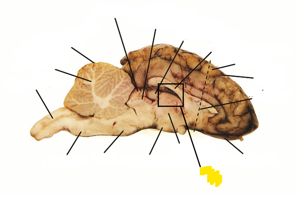 <p>Filled w/ CSF; Helps to protect the brain from injury and transport nutrients and waste.</p>
