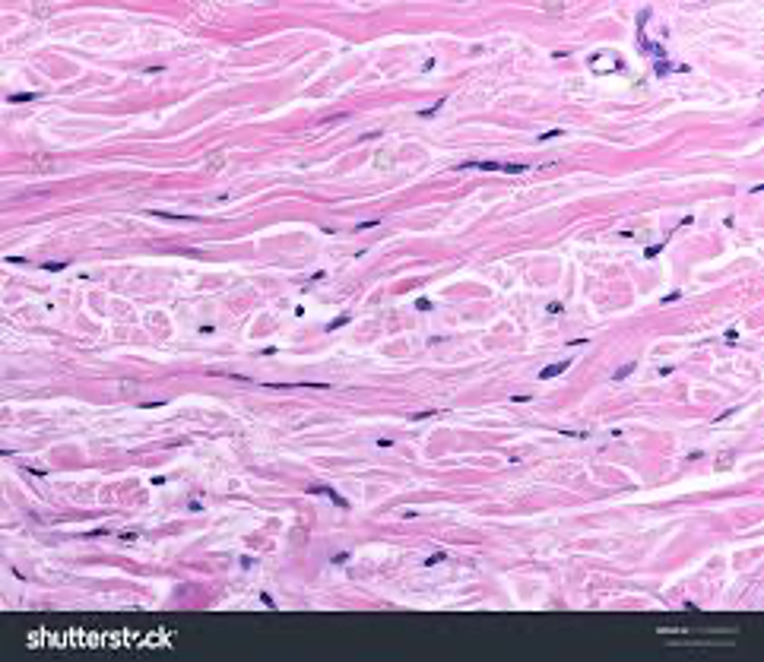 <p>arterial walls</p>