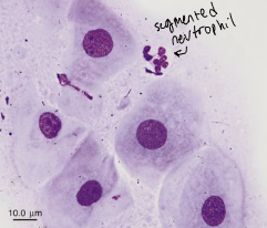 <p>You are looking at a canine vaginal smear through a microscope. ​</p><p>At what stage of the estrous cycle is this dog? </p>