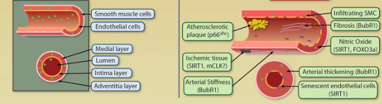 <p>Increase in thickness and stiffness in arteries<br>Decrease in lumen (opening)<br>Accumulation of plaques in arteries (atherosclerosis - normal part of aging)</p>