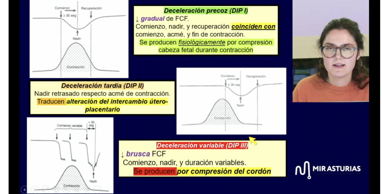 <p>Frecuencia cardiaca fetal durante el parto: desaceleraciones y tal </p>