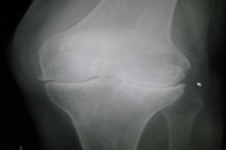 <p>What is the pathology?</p>