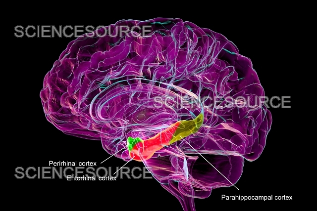 <p><strong>Object-recognition</strong> memory.</p>