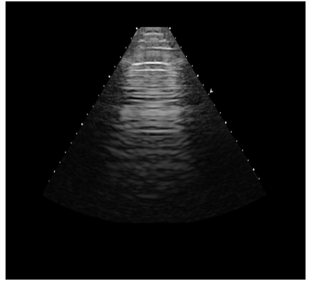 <p>What type of transducer produced the image?</p>