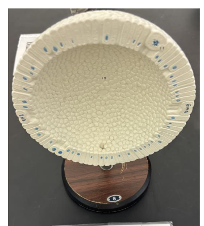 <p>what stage is this </p>