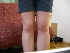 <p>knees</p>
