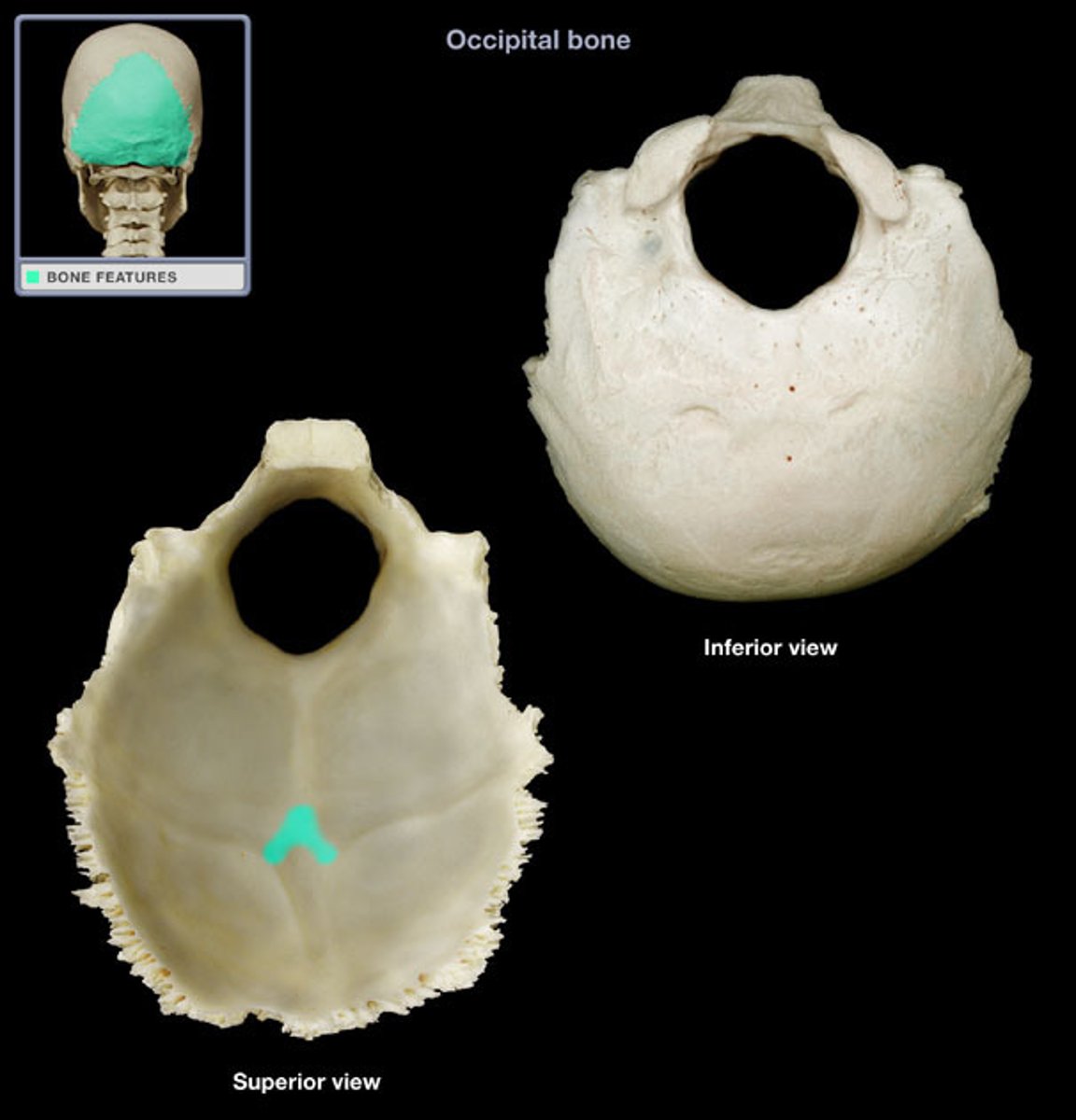 <p>What is this boney feature?</p>