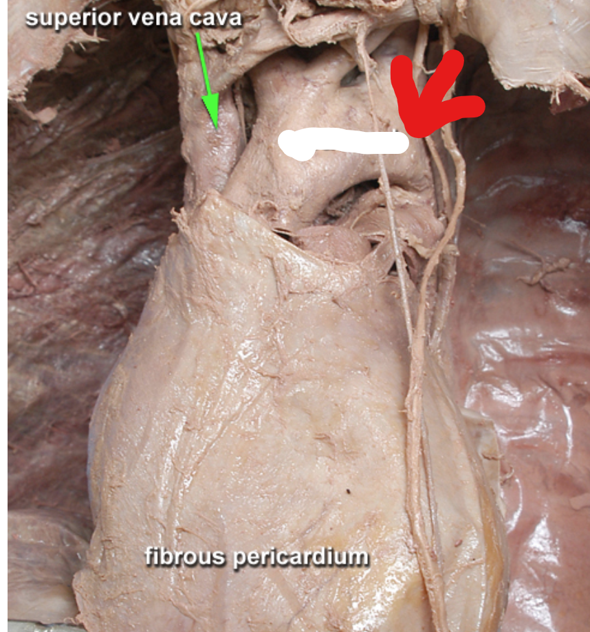 <p>What part of the heart is this?</p>