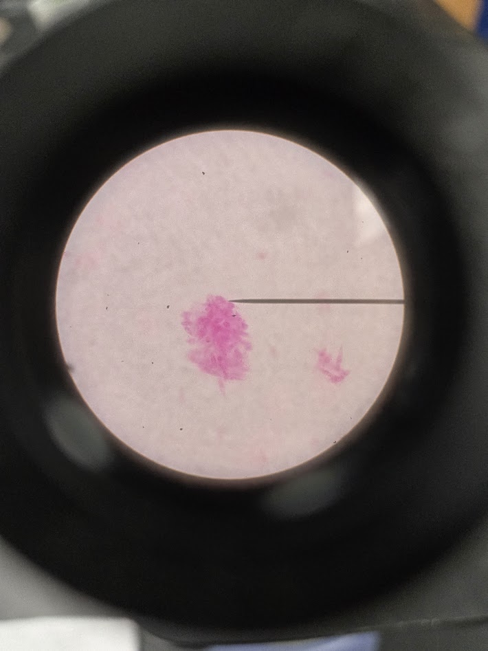 <ol><li><p>is this a bacteria or a protist?</p></li><li><p>what phylum?</p></li></ol><p></p>