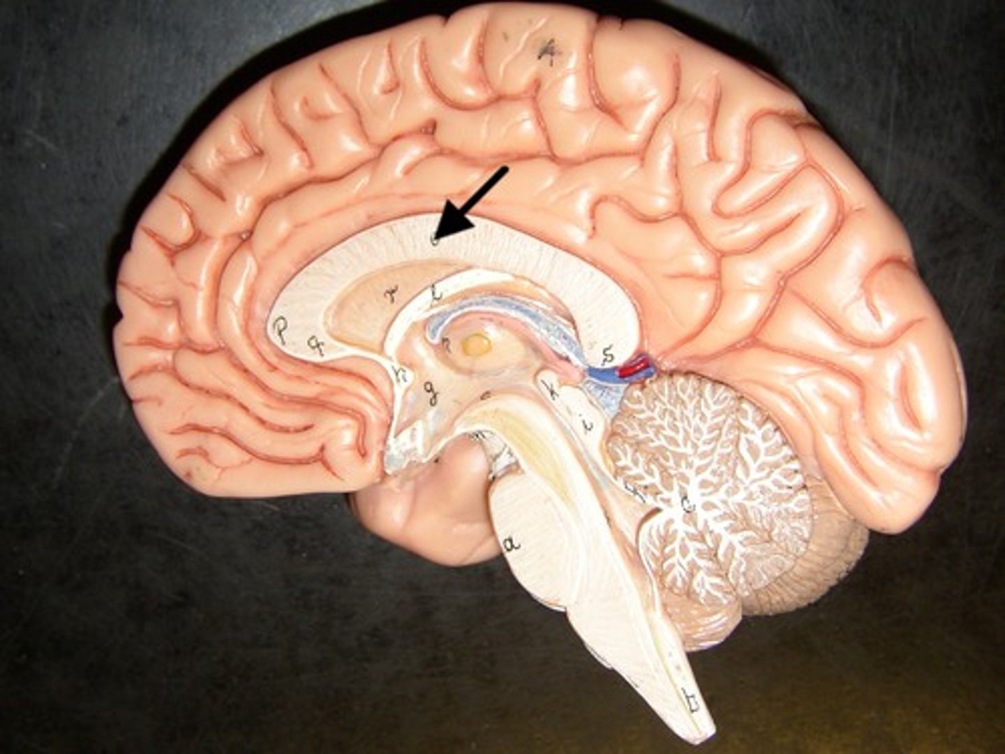 <p>A broad band of nerve fibers joining the two hemispheres of the brain.</p>