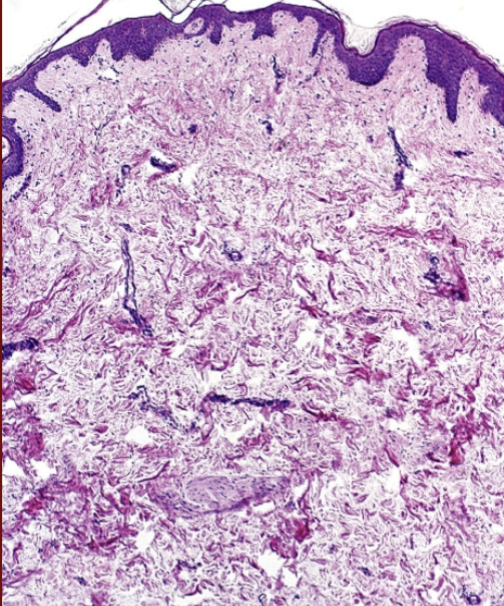<p>What is the lighter colored stuff of the dermis?</p>