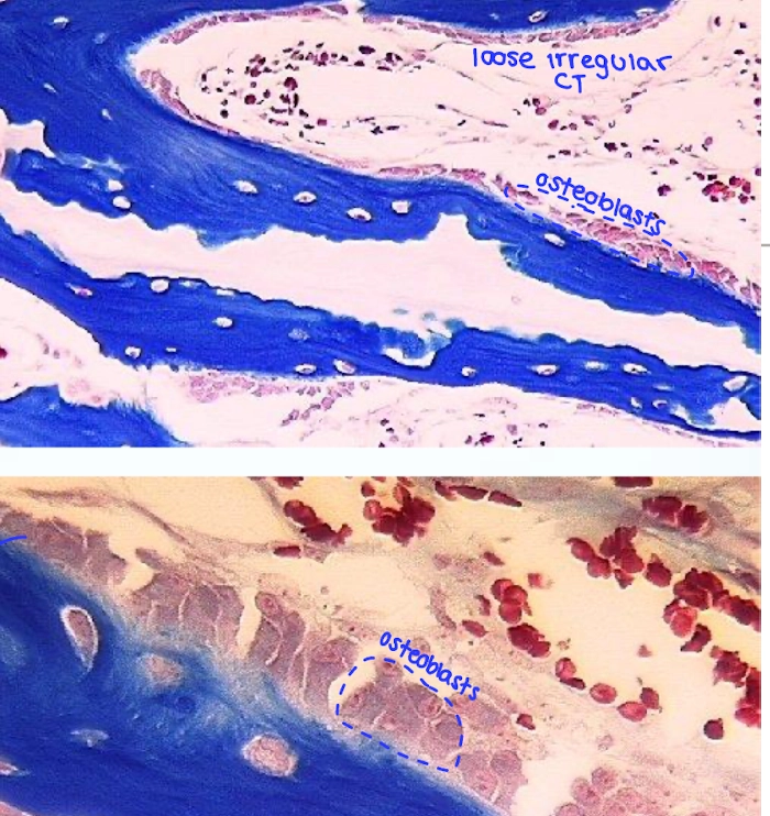<p>Look for active bone-forming cells lining the surface of bone. Unlike osteocytes, they are not enclosed in lacunae.</p>