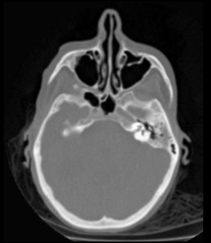 <p>What X-Ray machine was used for this image?</p>