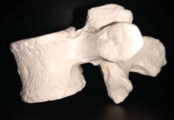 <p>Which vertebrae is this?</p>