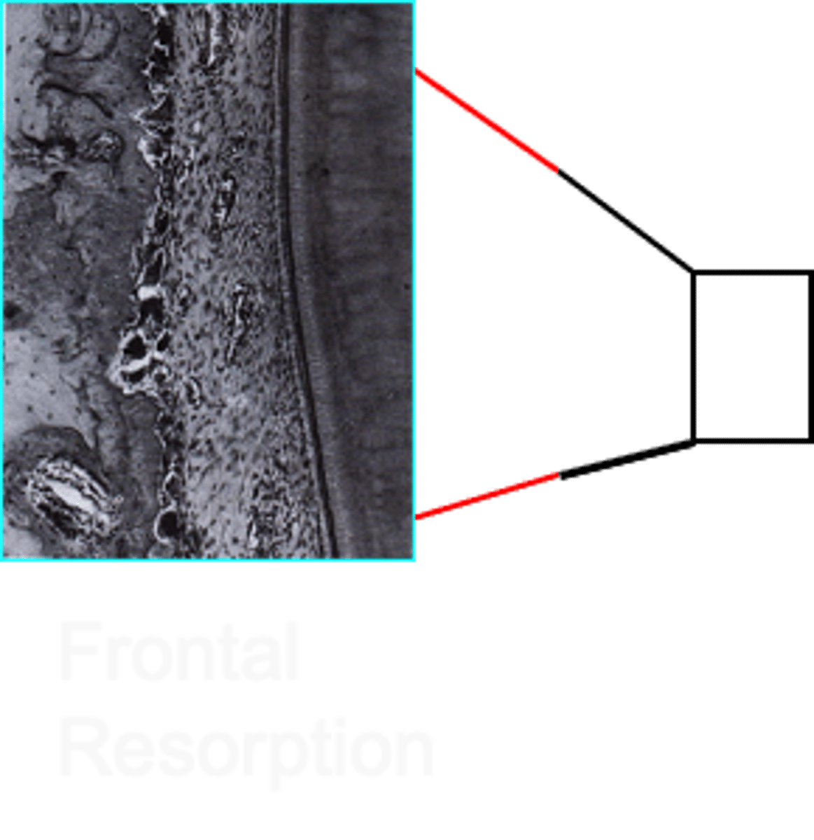 <p>ID the type of resorption:</p>