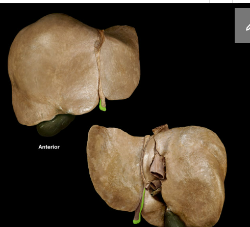 <p><span>Round ligament of liver</span></p>