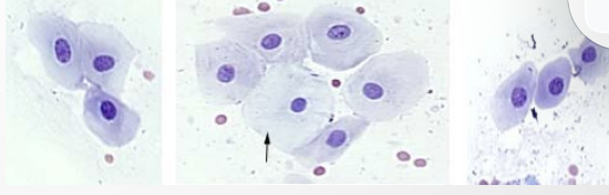 <p>The arrow is on a non-cornified superficial cell but the other cells are...?</p>