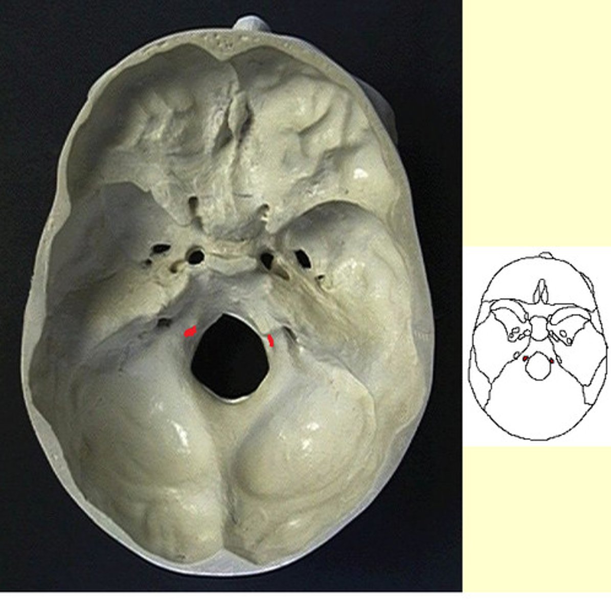<p>ID opening shown in red</p>