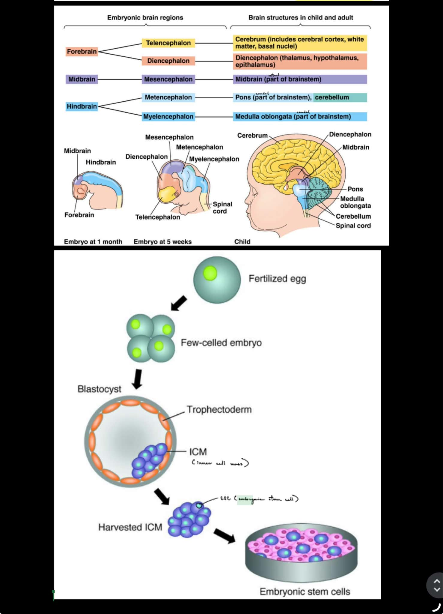 <p><strong><u>Zika</u></strong> — a mosquito-borne virus that can cause microencephaly (small brain size) in infants</p><p>true</p><div data-type="horizontalRule"><hr></div><p>forebrain</p><ul><li><p>→<strong> <u>tele</u></strong>|encephalon → <strong><u>cerebrum</u></strong></p></li><li><p>→ <strong><u>di</u></strong>|encephalon → <strong><u>thalamus, hypothalamus</u></strong></p></li></ul><p>midbrain</p><ul><li><p>→ <strong><u>mes</u></strong>|encephalon → <strong><u>brainstem</u></strong></p></li></ul><p>hindbrain</p><ul><li><p>→ <strong><u>met</u></strong>|encephalon → <strong><u>pons, cerebellum</u></strong></p></li><li><p>→ <strong><u>myel</u></strong>|encephalon → <strong><u>medulla</u></strong></p></li></ul><p>___</p><p>fertilized egg → embryo → blastocyst w/ ICM (inner cell mass) → harvested ICM → ESCs</p>