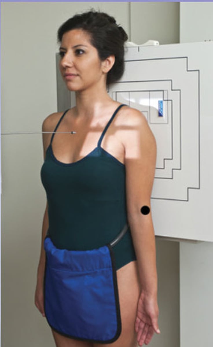 <p>S - around waist</p><p>T - 7 mAs @ 70 kVp</p><p>A - none</p><p>M - correct marker above shoulder</p><p>P - PT stands w/ back to board & epicondyles parallel, CR 1" below coracoid</p><p>S - 40"</p><p>B - suspension</p><p>C - 10 x 12 crosswise</p>