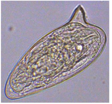 <p>why is the egg produces by the blood fluke <strong>easy</strong> to recognize?</p><p></p>