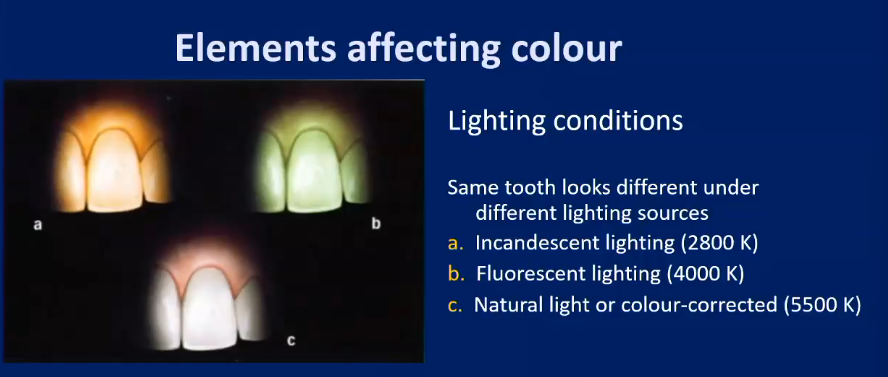 <ul><li><p>Incandescent lighting</p></li><li><p>Fluorescent lighting</p></li><li><p>Natural light or colour-corrected </p></li></ul><p>WC and Gd has colour corrected - switch off the bay light</p>