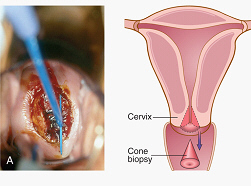 <p><span>The picture shows Amniocentesis Procedure:</span></p>