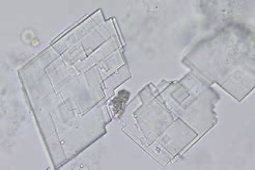 <ul><li><p>No clinical significance, normal.</p></li><li><p>Can be seen in normal urine samples of dogs.</p></li></ul><p></p>