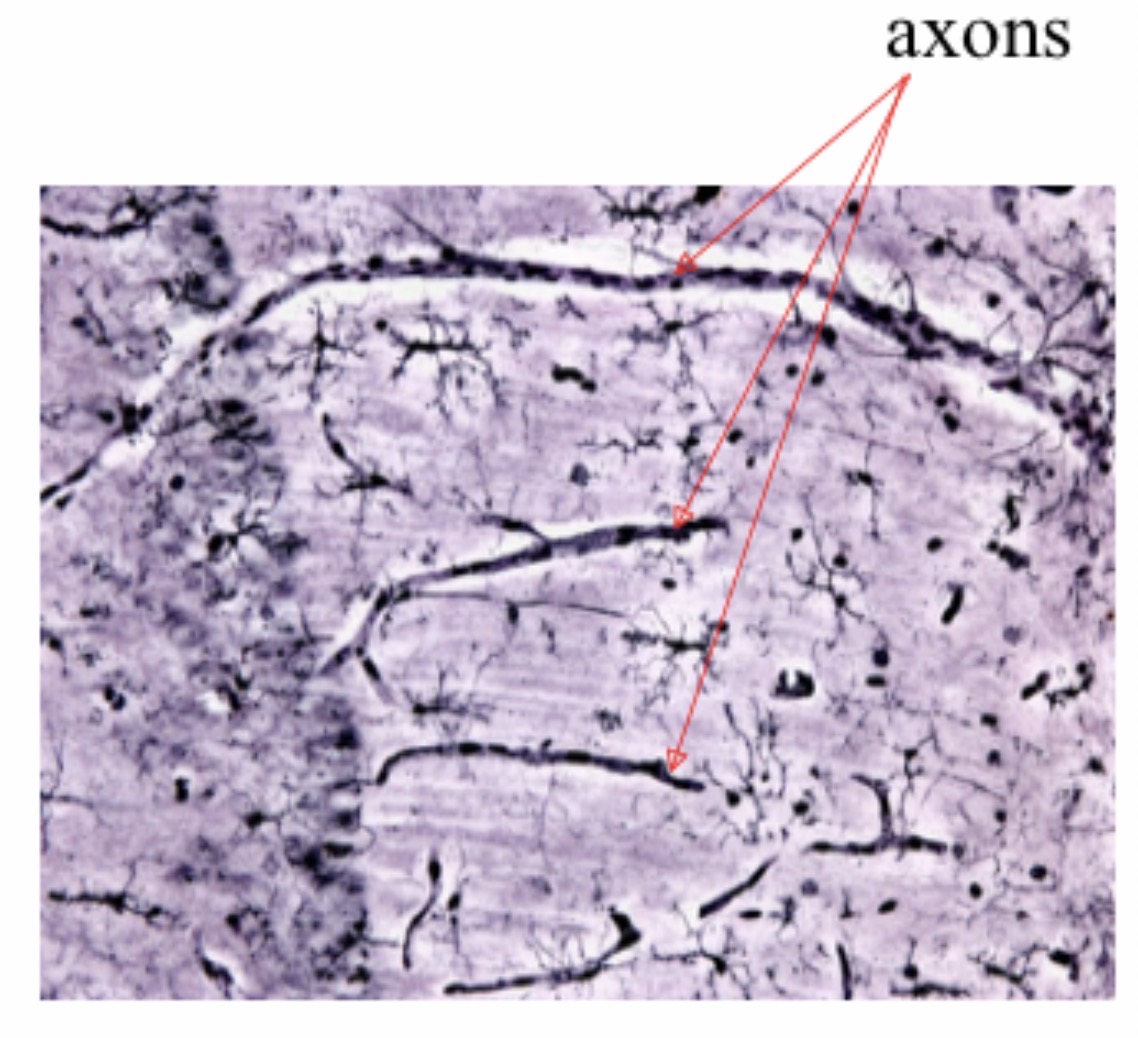 <p>Microglia Cell: Function: <span>Act as CNS immune cells; remove debris and pathogens. Small cells with elongated bodies, elongated nuclei with dense chromatin </span></p>
