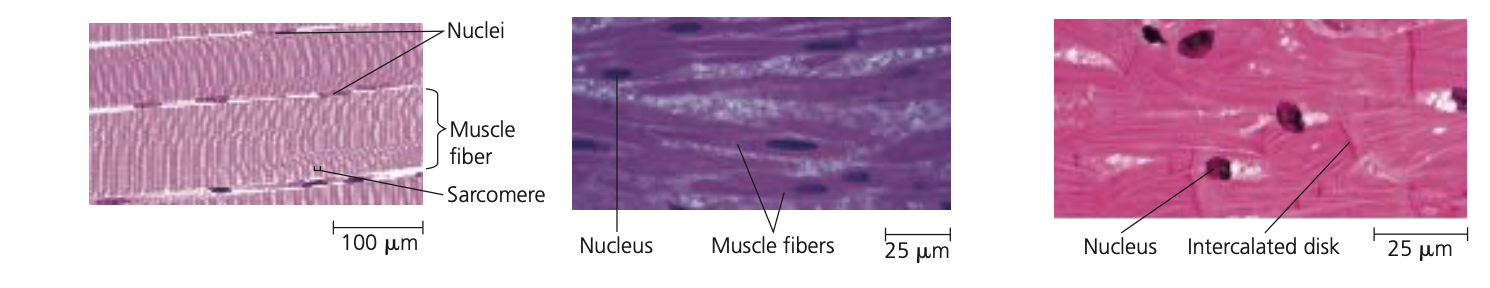 <ul><li><p>Skeletal muscle: <br>Attached to bones by tendons, skeletal muscle, or striated muscle, is responsible for voluntary movements<br> </p></li></ul><ul><li><p>Smooth muscle:<br>is found in the walls of the digestive</p><p class="p1">tract, urinary bladder, arteries, and other</p><p class="p1">internal organs. The cells are spindle-</p><p class="p1">shaped. Smooth muscles are responsible</p><p class="p1">for involuntary body activities, such as</p><p class="p1">churning of the stomach and constric-</p><p class="p1">tion of arteries.</p></li><li><p>Cardiac muscle:<br>Cardiac muscle forms the contractile</p><p class="p1">wall of the heart. It is striated like skeletal</p><p class="p1">muscle and has similar contractile proper-</p><p class="p1">ties. Unlike skeletal muscle, however, car-</p><p class="p1">diac muscle has branched fibers that inter-</p><p class="p1">connect via intercalated disks, which relay</p><p class="p1">signals from cell to cell and help synchronize</p><p class="p1">heart contraction</p></li></ul><p></p>