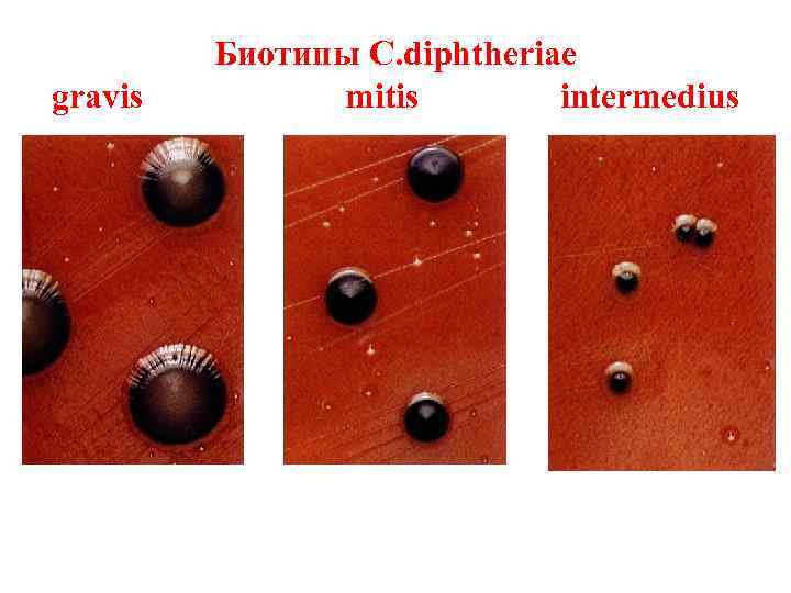 <p>Según su morfología crecimiento de biotipos de C. Dipherheriae crecen en agar telurito (medio de Tinsdale),</p><p></p><p>- Mitis </p>