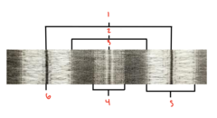 <p>What is labeled 1?</p>