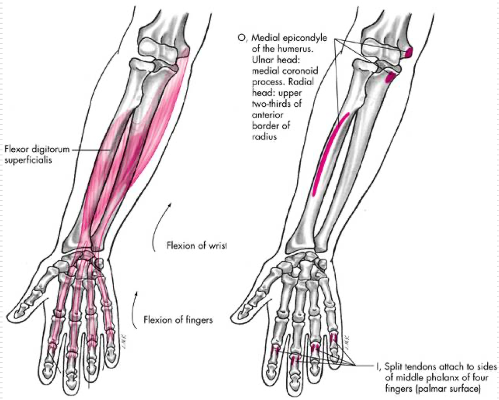 <p>Flexion of fingers 2-5 </p><p>Flexion of wrist </p><p>O - Medial epicondyle of humerus, proximal half of anterior border of radius </p><p>I - Palmar aspects of the bodies of middle phalanges fingers 2-5 </p>