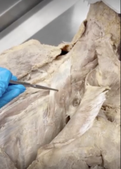 <p>Name the Muscle</p>